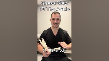 How To Perform A Stress View Of The Ankle On XR #shorts #xray #ortho