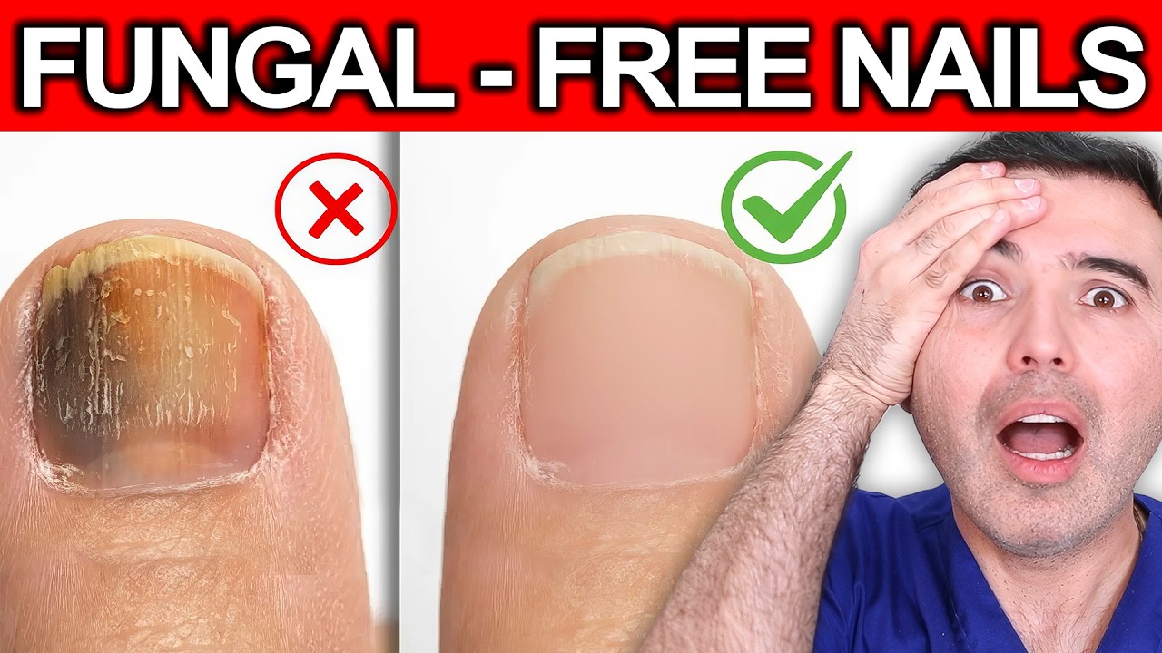 KILL TOENAIL FUNGUS OVERNIGHT - 4 Kitchen Ingredients That Destroy Fungus Forever