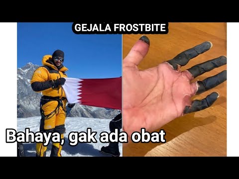 Jangan DISEPELEKAN !! Tonton ini sebelum Healing di gunung!