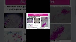 Lab Bacteria Secondary Stains Slide Review in 1 minute #biology #microbiology #science #lab