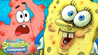 SpongeBob | Alle Bikini Bottom-PICKELPANNEN! | SpongeBob Schwammkopf