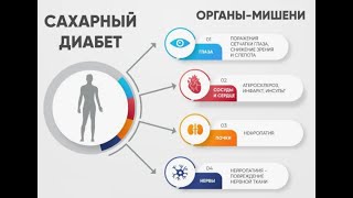 Сахарный диабет и другие болезни поджелудочной железы