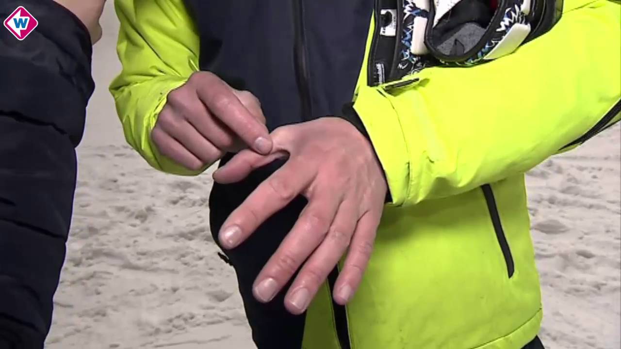 Skiërs opgelet: Delftse chirurg ontwerpt bescherming tegen ski-duim