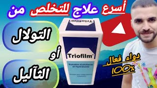 Trofilm  دواء فعال للتخلص من التولال أو ثآليل او الزوائد الجلدية بصفة نهائية/مكوناته/موانعه/ثمنه