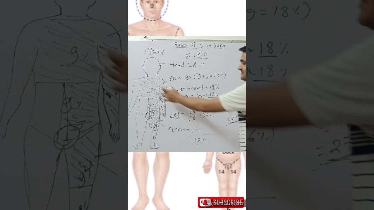 Rule Of 9 In Burns For Child Nine Shorts Reels