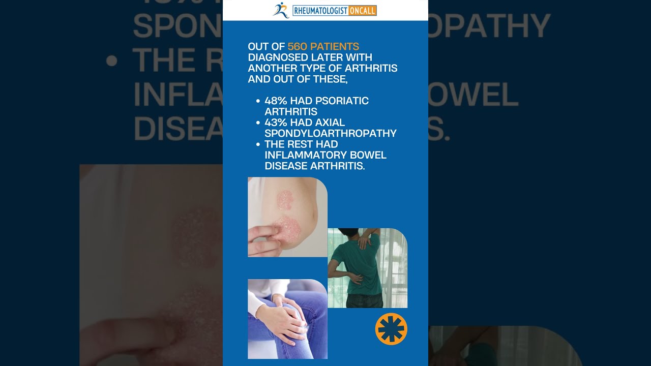 Reveal The Secrets Of Seronegative Rheumatoid Arthritis