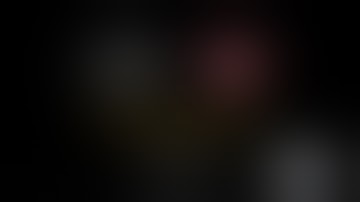 Calcified Mediastinal Lymph Nodes - Subcarinal Dissection