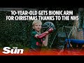 10-year-old receives &#39;Iron Man&#39;-themed bionic arm for Christmas thanks to the NHS