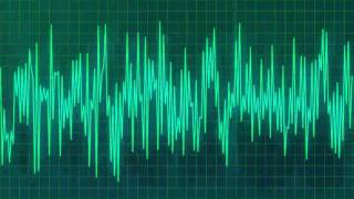 FLATLINE - Die Smiling (dubstep)