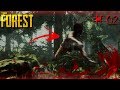 KINH HOÀNG THỔ DÂN TẤN CÔNG !!! | The Forest w/ Dương FG [2]