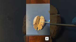 Sheep Brain Dissection