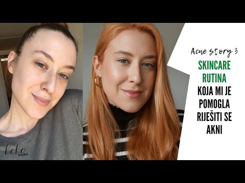 Ovo je SKINCARE RUTINA koja mi je pomogla RIJEŠITI SE (hormonalnih) AKNI!/acne story 3 ~ Koko