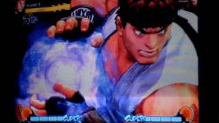 Ryu Ultra Set up