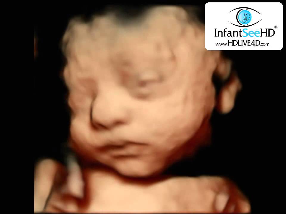 OMG BABY OPENS EYES IN ULTRASOUND HD LIVE 4D - YouTube