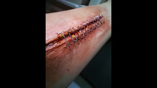 Stapled Wound SFX Makeup Tutorial | Malou Toledo