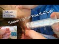 Removing Ear Wax Buildup at Home! Flushing Out Ear Wax w/ Hydrogen Peroxide! Ear Irrigation Review!