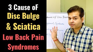 Cause of Lower Back Pain, Low Back Pain Treatment, Postural Back Pain, Herniated Disc & Sciatica