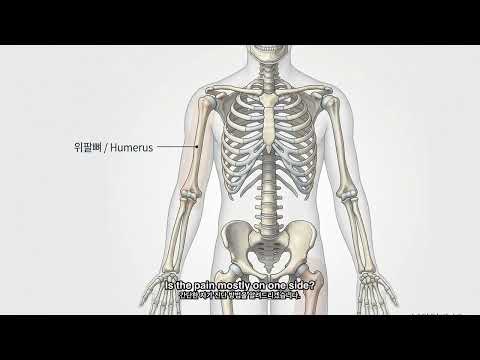 Sciatica Explained - Symptoms, Causes, How Long It Lasts, and When to See a Doctor