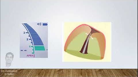 Apex locators - Correct method to measure working length !!