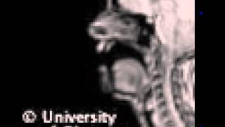 MRI uvular fricative