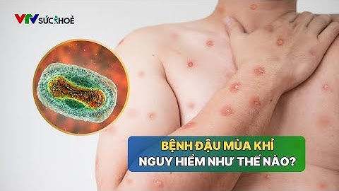 Biến thể đậu mùa khỉ mới nguy hiểm như thế nào? | VTV Sức khỏe