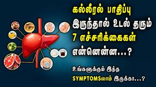 Liver Damage ஆக இருந்தால் என்னென்ன Symptoms இருக்கும்? | What are the symptoms of liver damage?