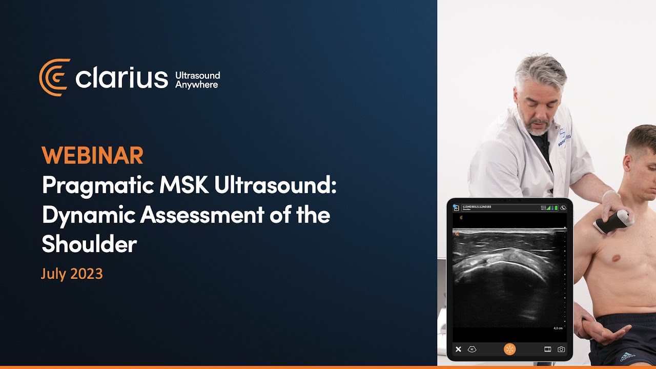 Pragmatic msk ultrasound dynamic assessment of the shoulder youtube