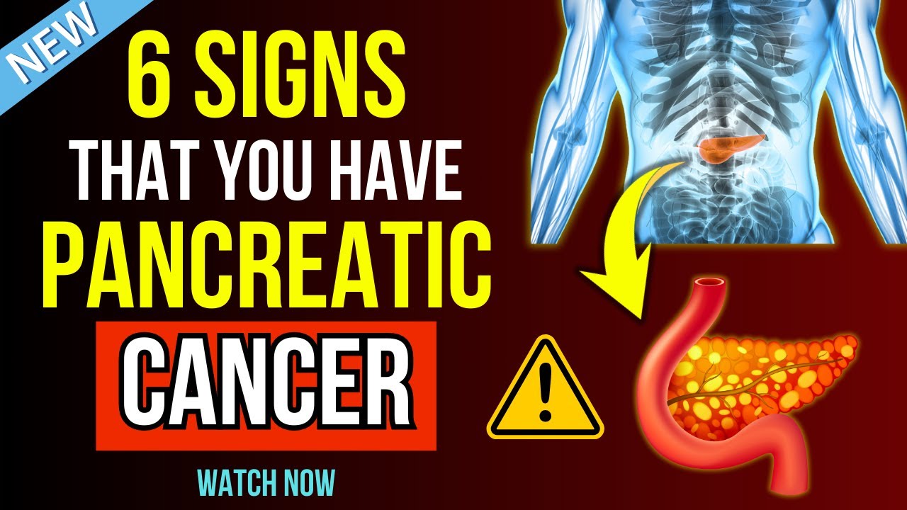 PANCREATIC CANCER Symptoms You Need To Know - YouTube