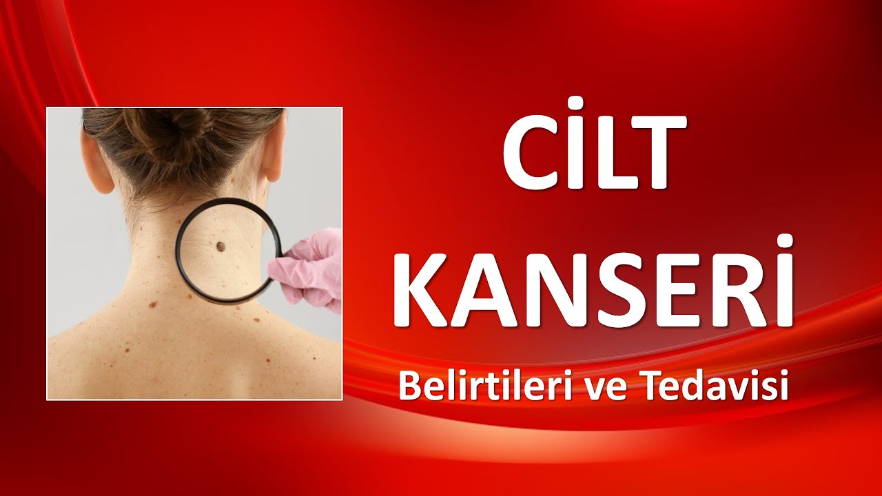 CİLT KANSERİ Nedenleri, Belirtileri ve Tedavisi