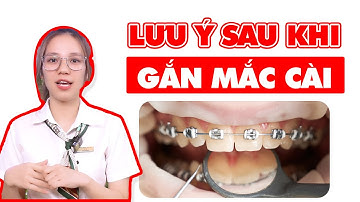 Lưu Ý Sau Khi Gắn Mắc Cài Niềng Răng | Bác sĩ Thu Gia Lâm