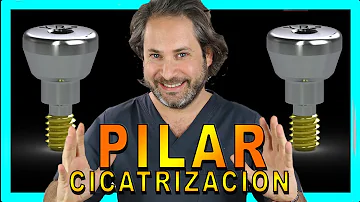 ¿Duele la colocación del pilar?