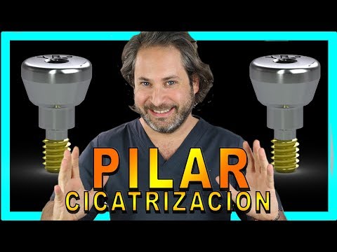 Video: ¿Duele el pilar del implante?