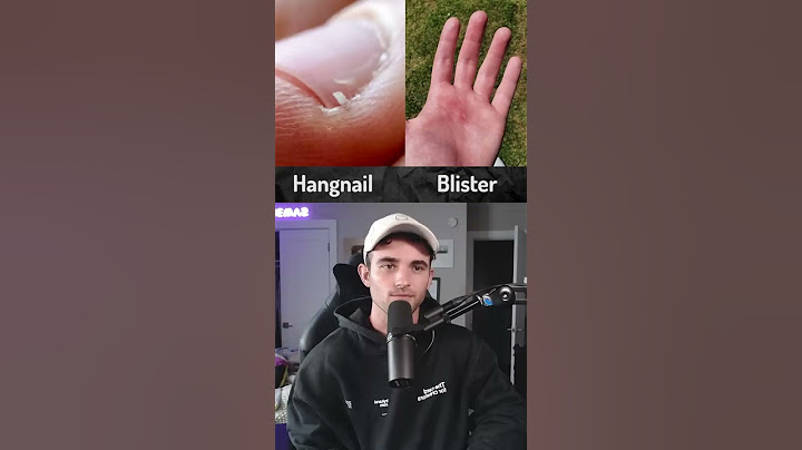 What's more painful?