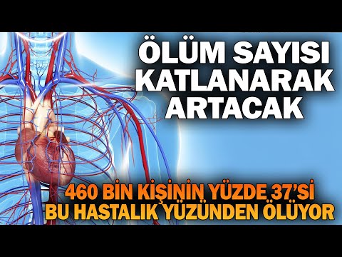 İnsanların Yüzde 37'si Bu Hastalık Yüzünden Ölüyor. Korunmak İçin 3 Şeyi Yapınız.