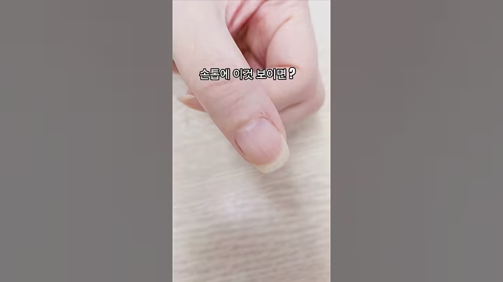 손톱에 이것 보이면? #생생정보tv #cutecat #cuteanimals