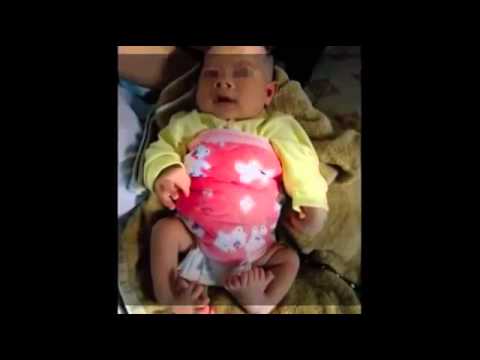 閲覧注意 中国大気汚染 水質汚染で生まれる奇形児たち ｐｍ２ ５とは Youtube