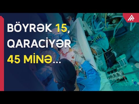 Azərbaycanda meyitlərdən kimlərə orqan köçürüləcək? – YENİ QANUN