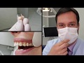 Dr. Juliano Coura - O provisório perfeito para espera do Implante dentário!
