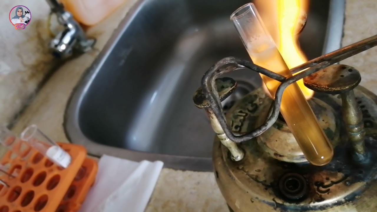 شرح اختبار الكشف عن البروتين في البول بالتفصيل