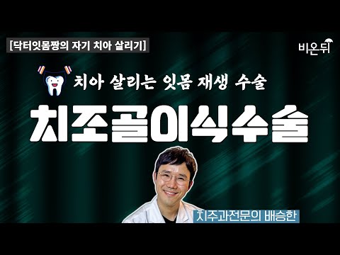 [닥터잇몸짱의 자기 치아 살리기] &rsquo;잇몸 재생 수술 - 치아 살리는 치조골 이식수술&rsquo; (치주과전문의 배승한)