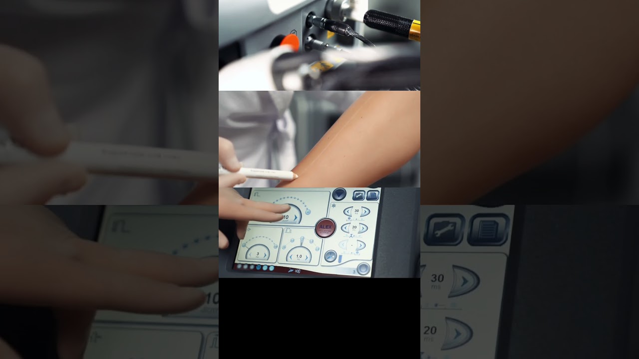 Candela GentleLase Pro по предзаказу 48000$ вместо 55000$ — пока доллар держится на 84,6₽ @nist_pro