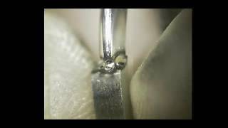 Super fit arthritis custom shank