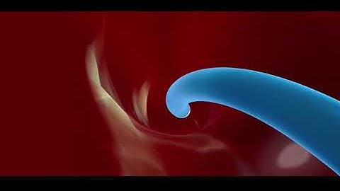 Prostate Artery Embolization
