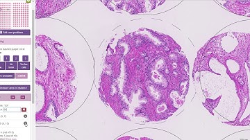 Navigating TMA Cores in Slide Score