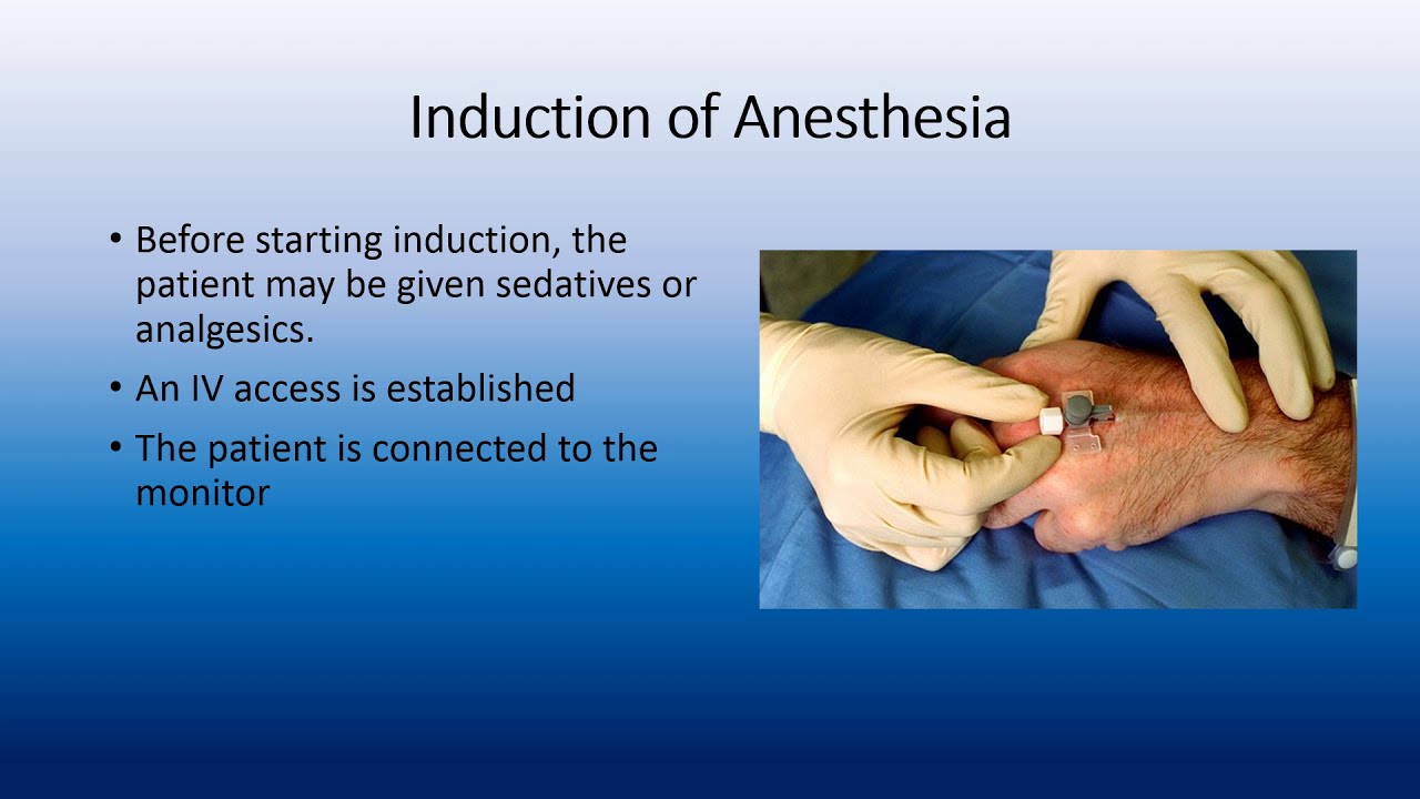 general anesthesia YouTube