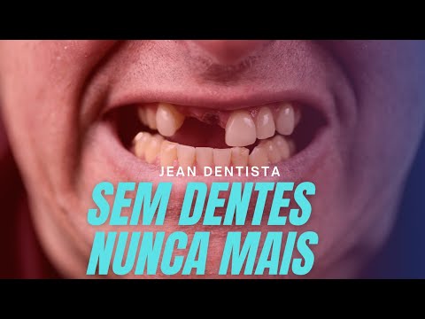 Vídeo: Você consegue fazer dentaduras sem moldagem?