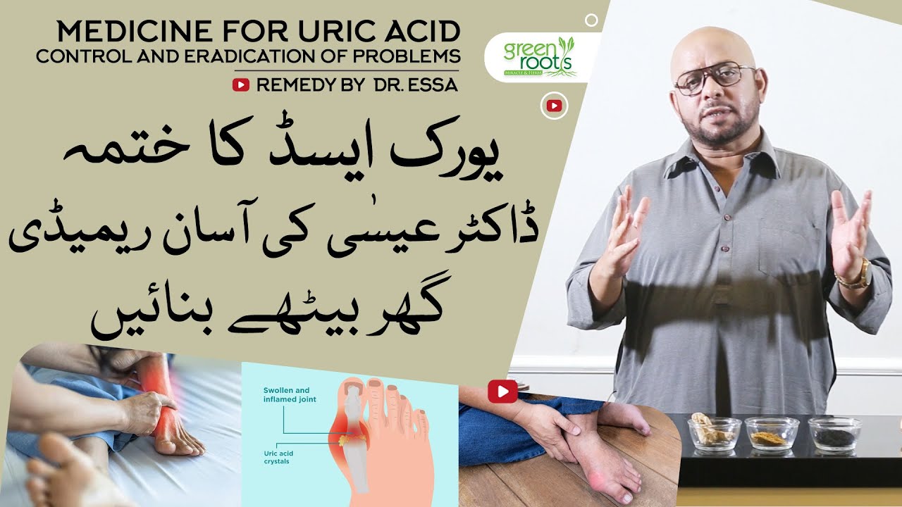 Uric Acid home treatment remedy by Dr Essa controls uric acid