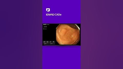 ENAD CADe for Colonoscopy｜Colonoscopy AI Software