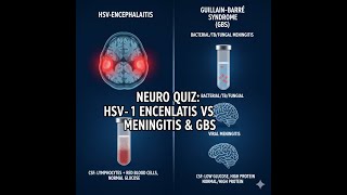 Hsv-1 Encephalitis Profiles Usmle - How Is It Different From Gbs, Tb, Fungal, Bacterial Meningitis?