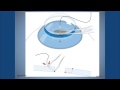 Corneal Suturing, Part 1- A Curriculum for Suturing the Cornea